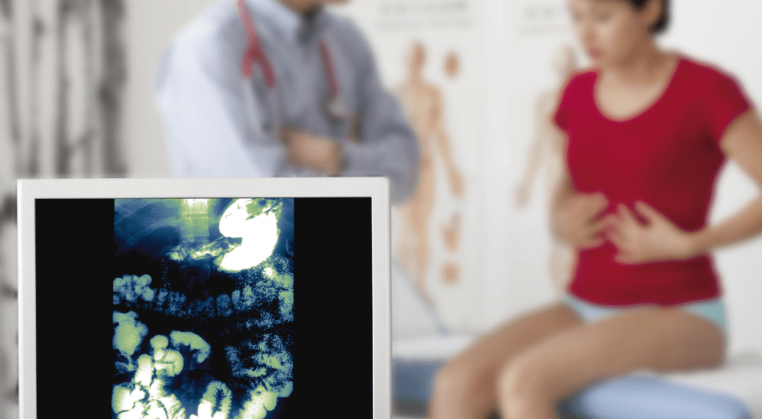 cáncer de colon diagnóstico