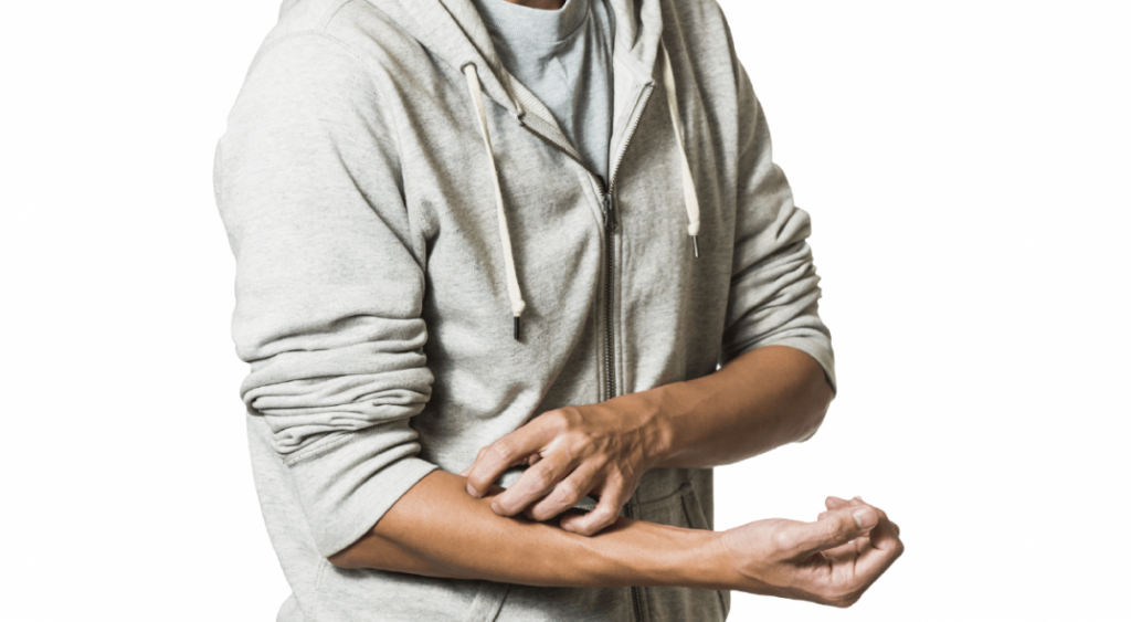 urticaria por estrés