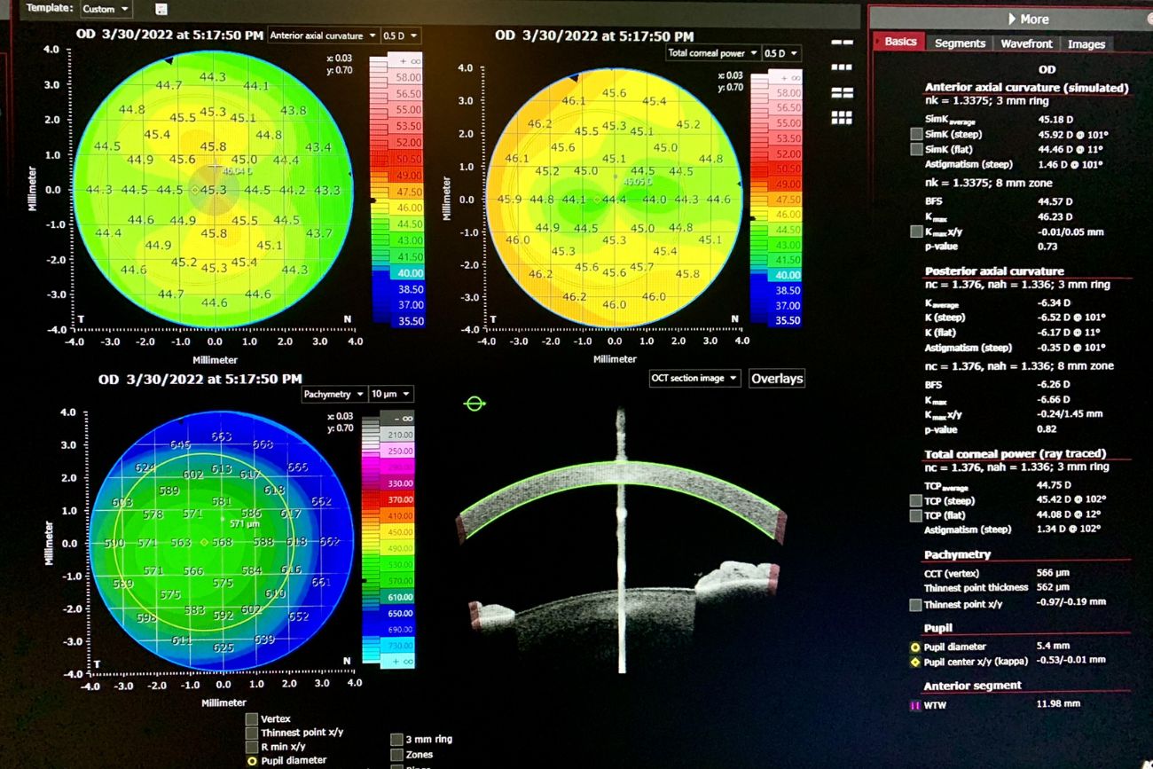 Gracias a distintos equipos diagnósticos de alta complejidad tecnológica, se complementa la actividad clínica del oftalmologo