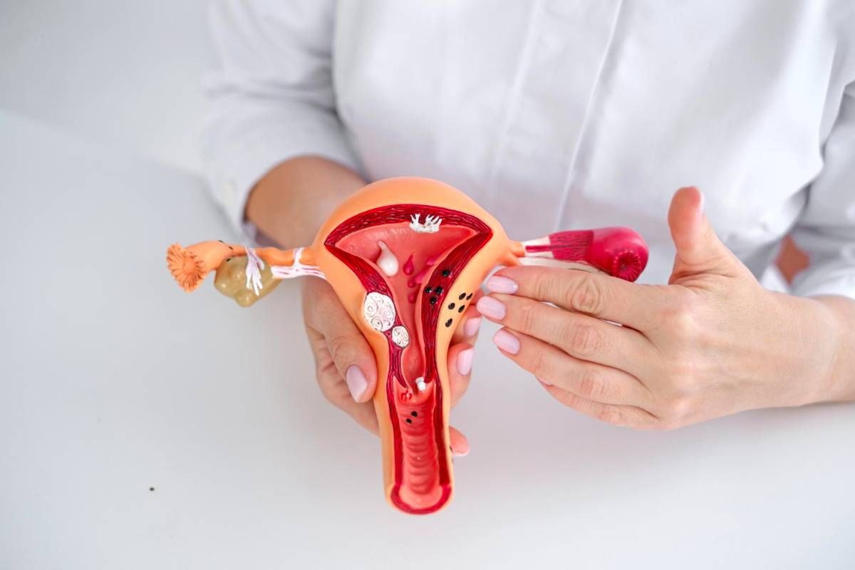 Endometriosis: por qué un diagnóstico temprano y un abordaje integral pueden mejorar la calidad de vida