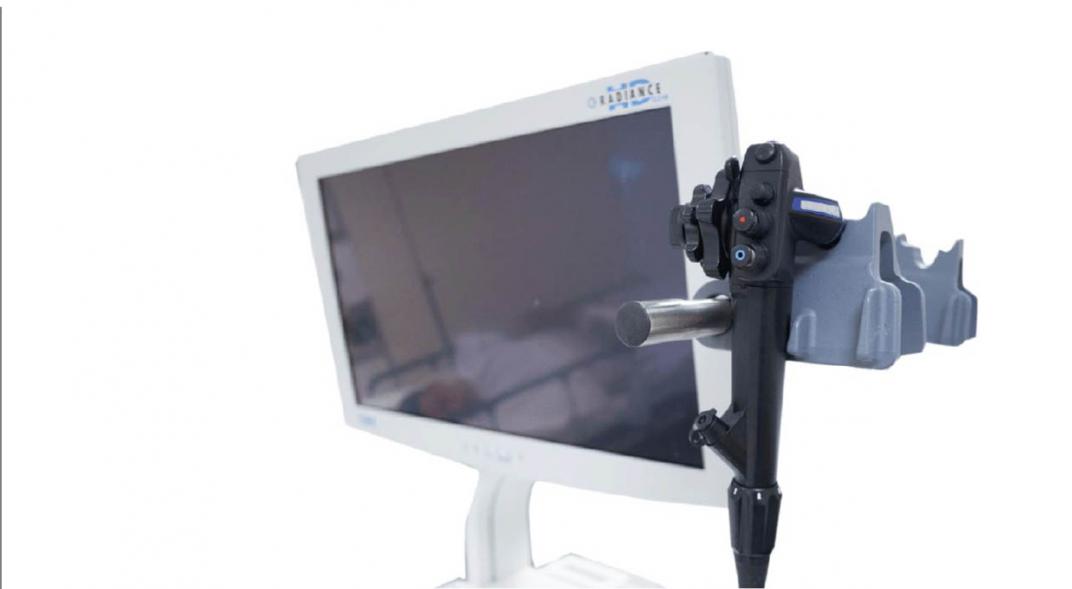 ecoendoscopía