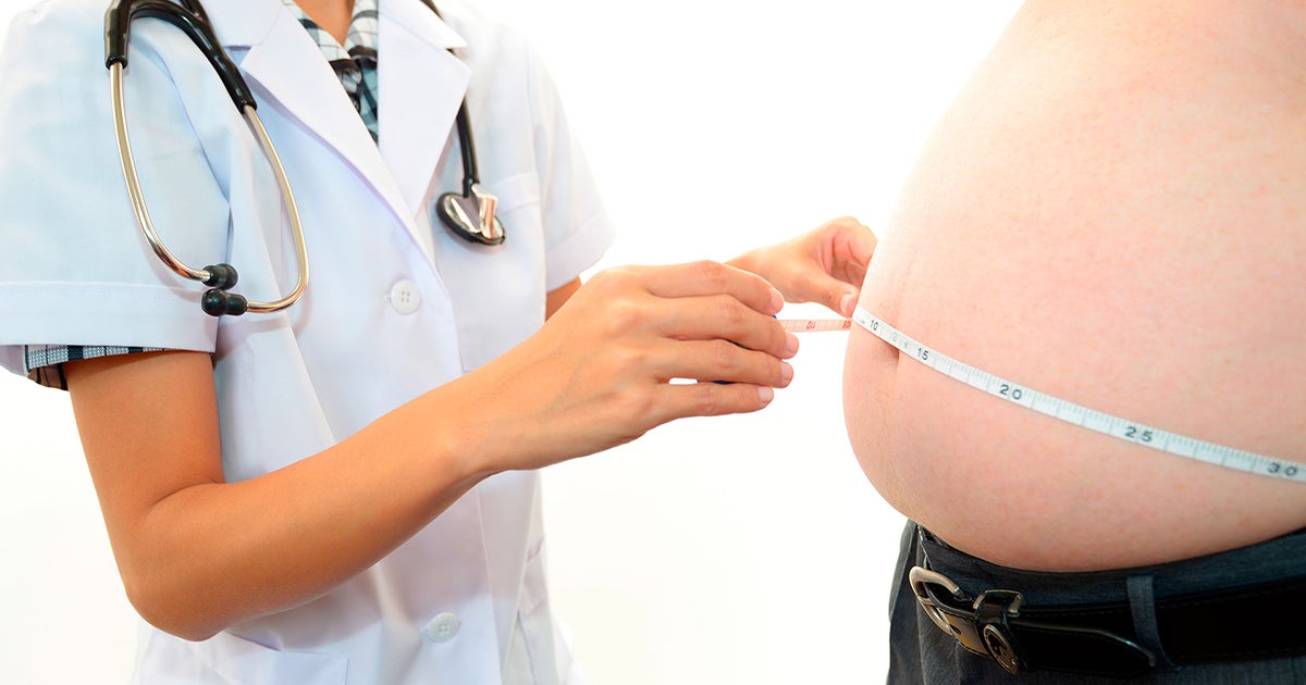 Becas Congreso Argentino de Obesidad