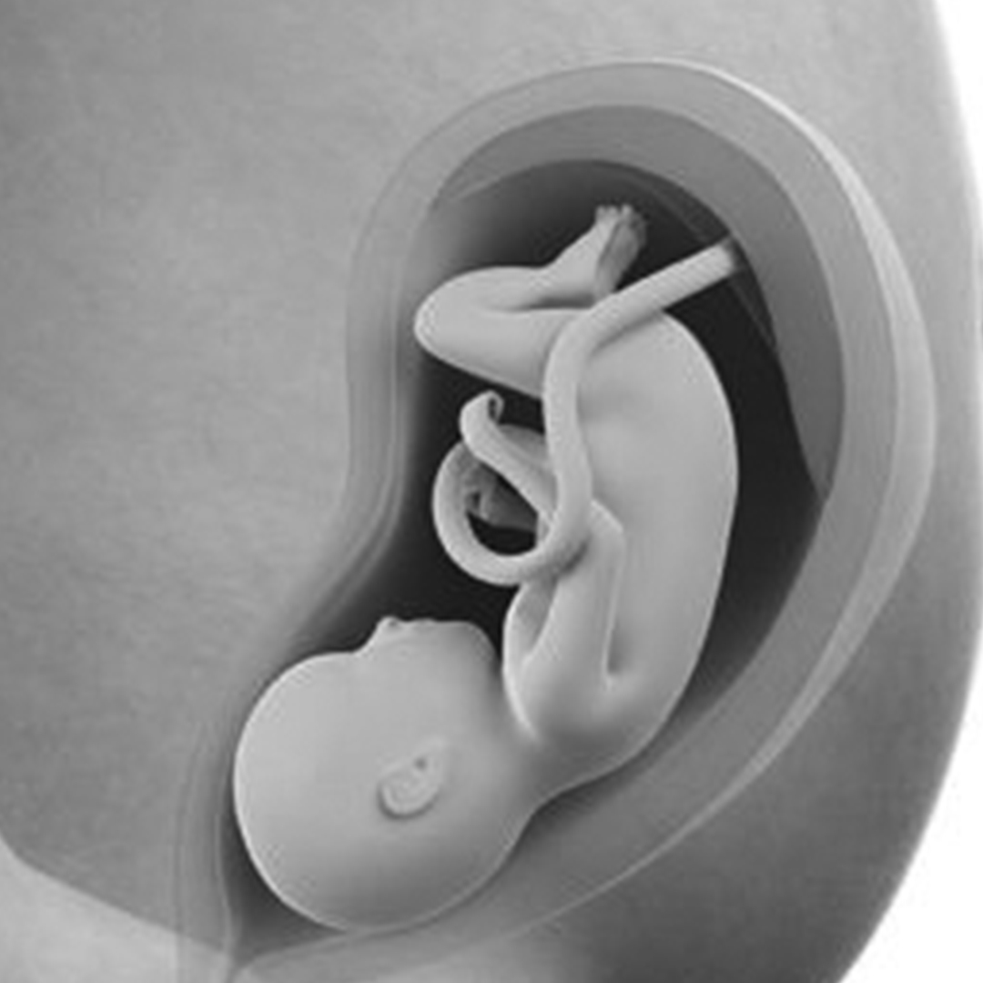 Curso Intensivo de Cardiología Fetal