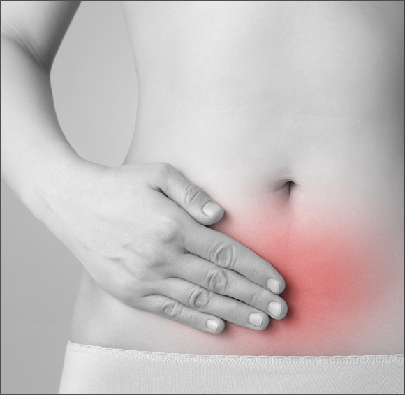 Curso de Manejo Endovascular del Síndrome de Congestión Pélvico