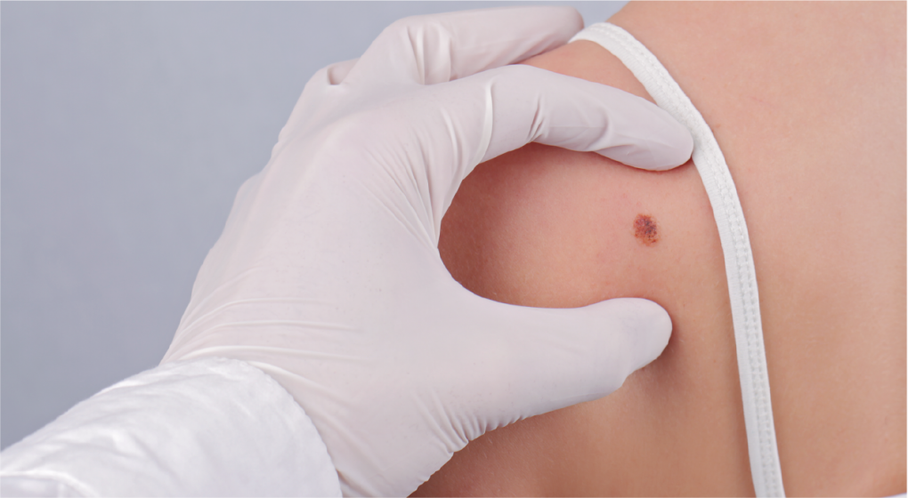 dermatología