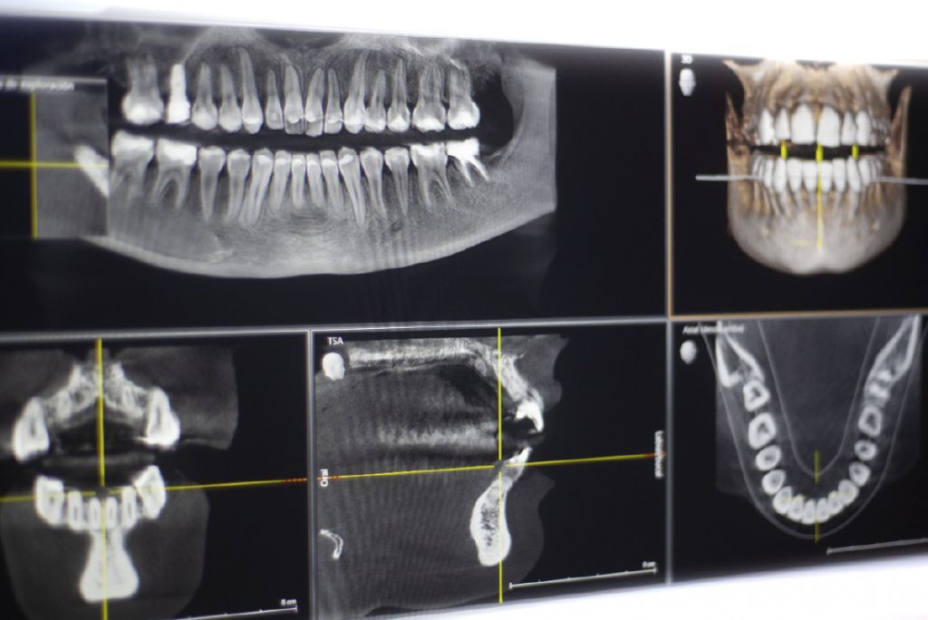 ortopantomografia diagnosticos odontologicos
